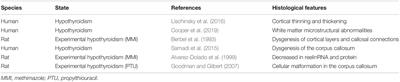 Congenital Hypothyroidism and Brain Development: Association With Other Psychiatric Disorders